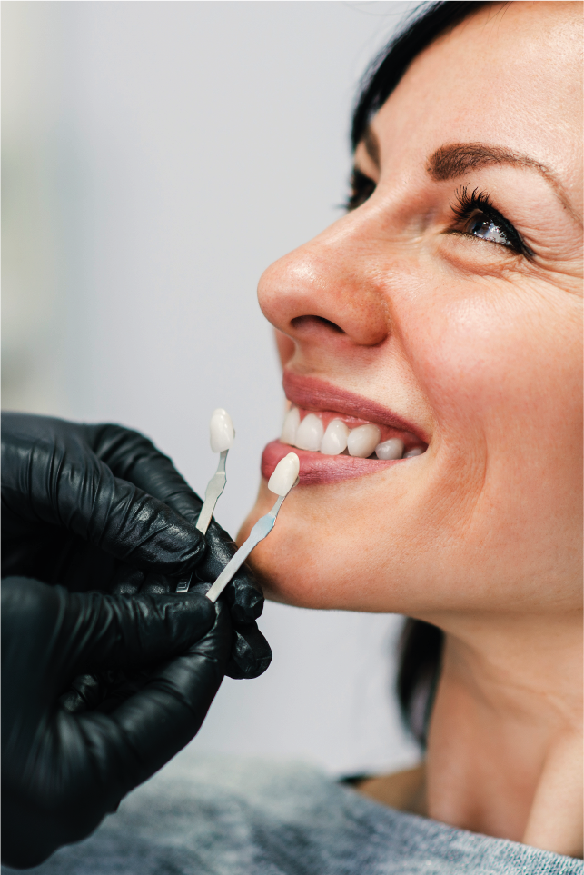 estética dental en Sevilla